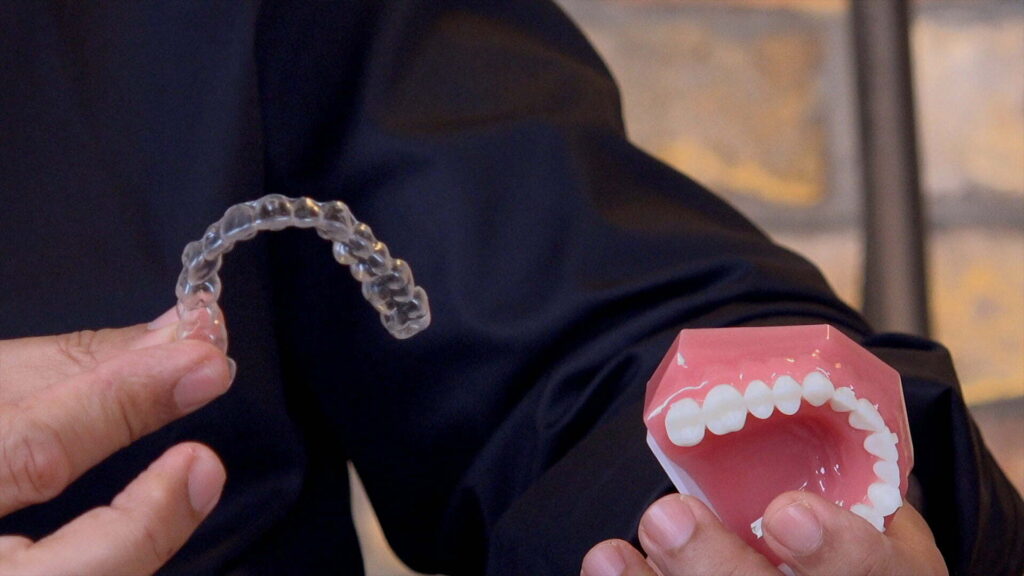 יישור שיניים – הסבר למטופלים